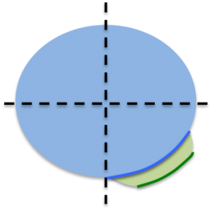 4 representacion protrusion