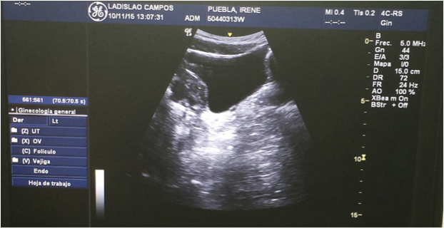 El papel de la ecografía en las disfunciones del suelo pélvico